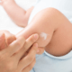 Atopik Dermatit İçin Doktora Giderken Nasıl Hazırlık Yapılmalıdır?