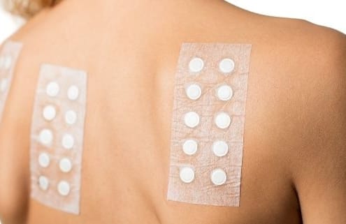 Diş Tedavisinde Metal Yama Testi Nedir